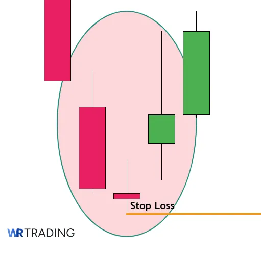 Stop Loss of a Bullish Abondoned Baby Pattern